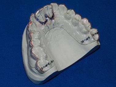 gabinet stomatologiczny Gliwice, ortodonta