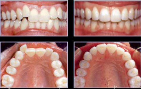 gabinet stomatologiczny Gliwice, ortodonta